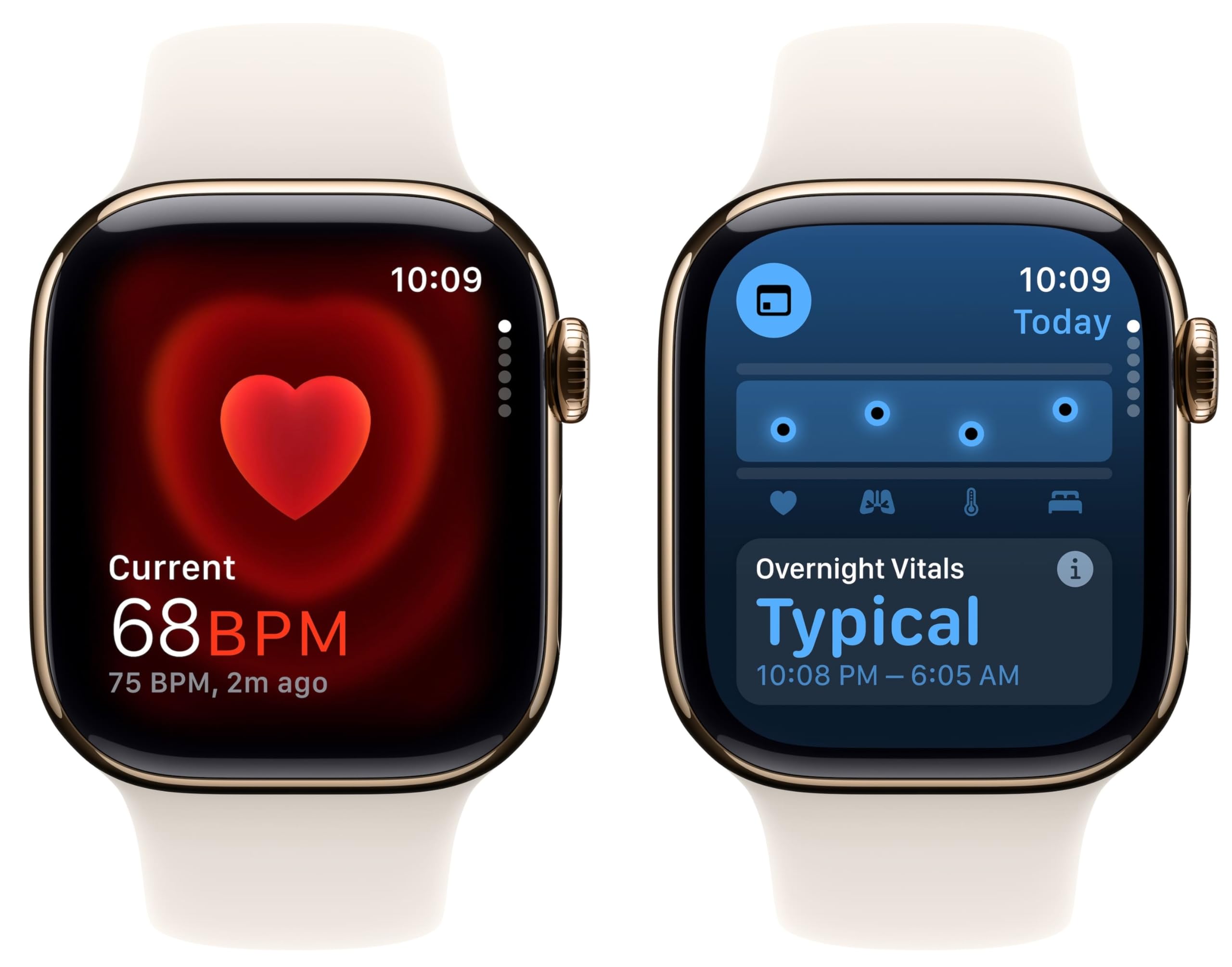 Amazon.com: Apple Watch Series 10 [GPS + Cellular, 46mm